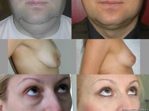 "����������" � ����� �������