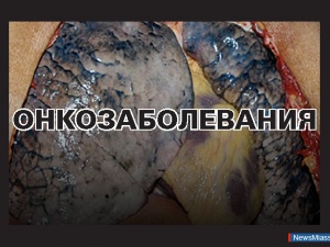 ��������� ���� �� �������